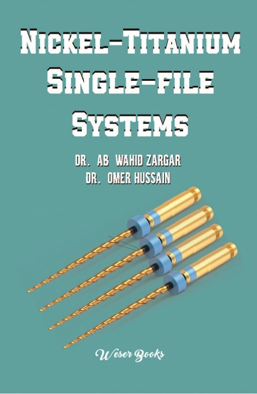 Nickel-Titanium Single-File Systems