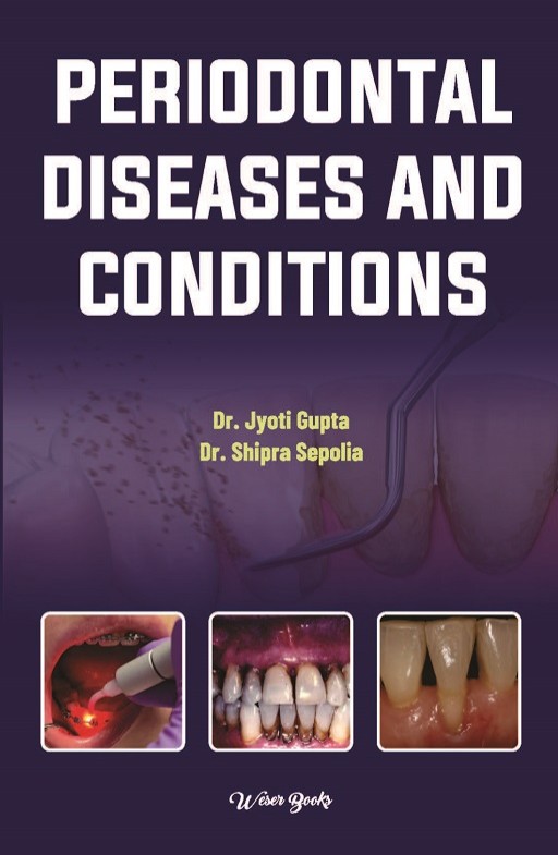 Periodontal Diseases and Conditions
