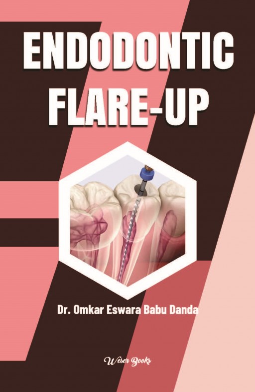 Endodontic Flare-Up