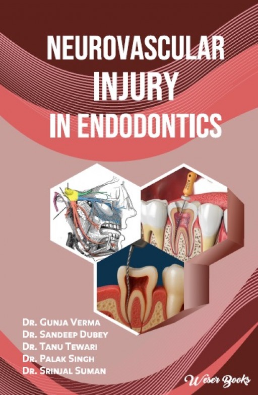 Neurovascular Injury in Endodontics