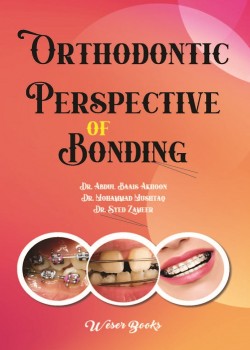 Orthodontic Perspective of Bonding