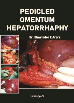 Pedicled Omentum Hepatorrhaphy