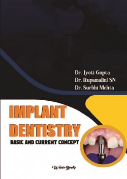 Implant Dentistry: Basic and Current Concept