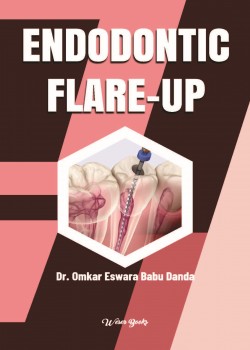 Endodontic Flare-Up