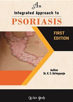 An Integrated Approach to Psoriasis