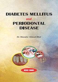 Diabetes Mellitus and Periodontal Disease